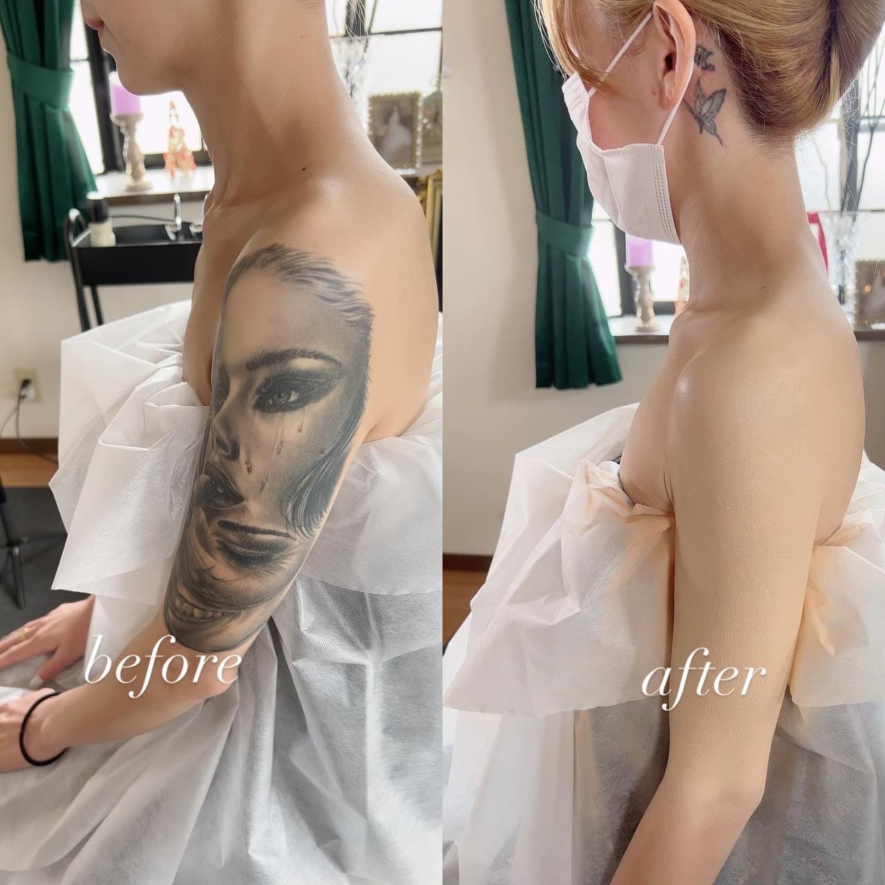 ブライダルボディカバーメイクはウエディングドレスを着て露出する腕や肩のタトゥーも隠せます