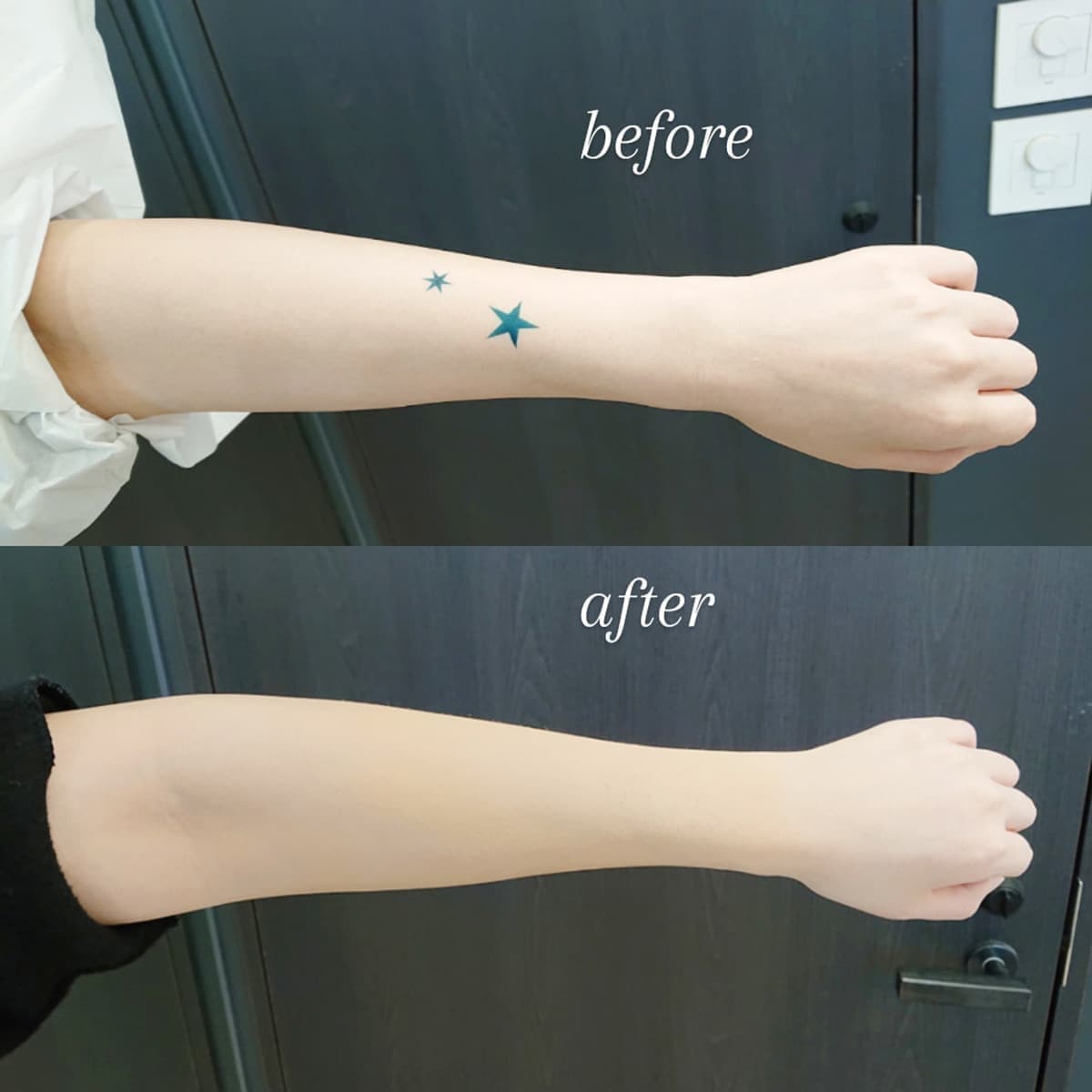 腕のワンポイント・タトゥも綺麗にカバーできます